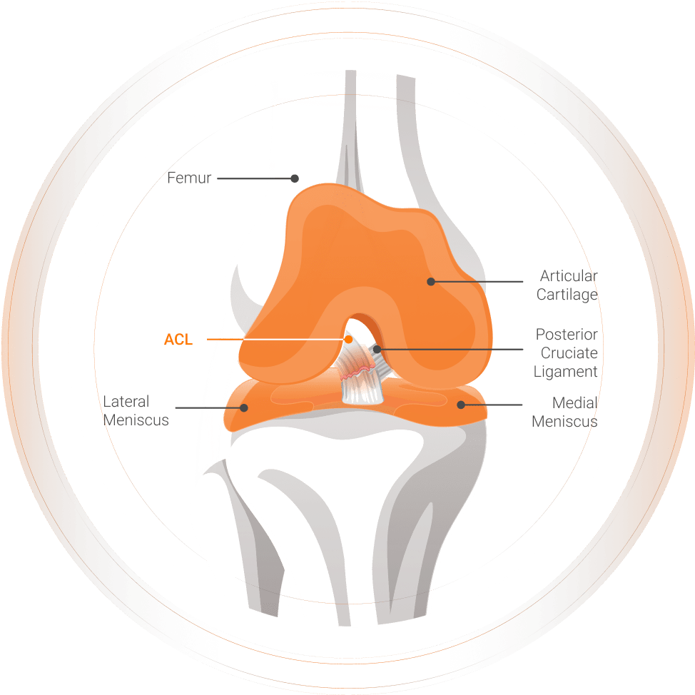 ACL anatomy